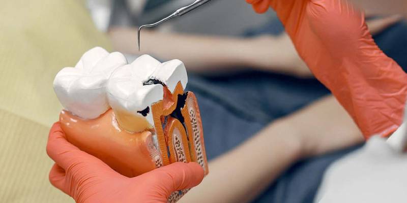 Kanal Tedavisi (Endodonti)